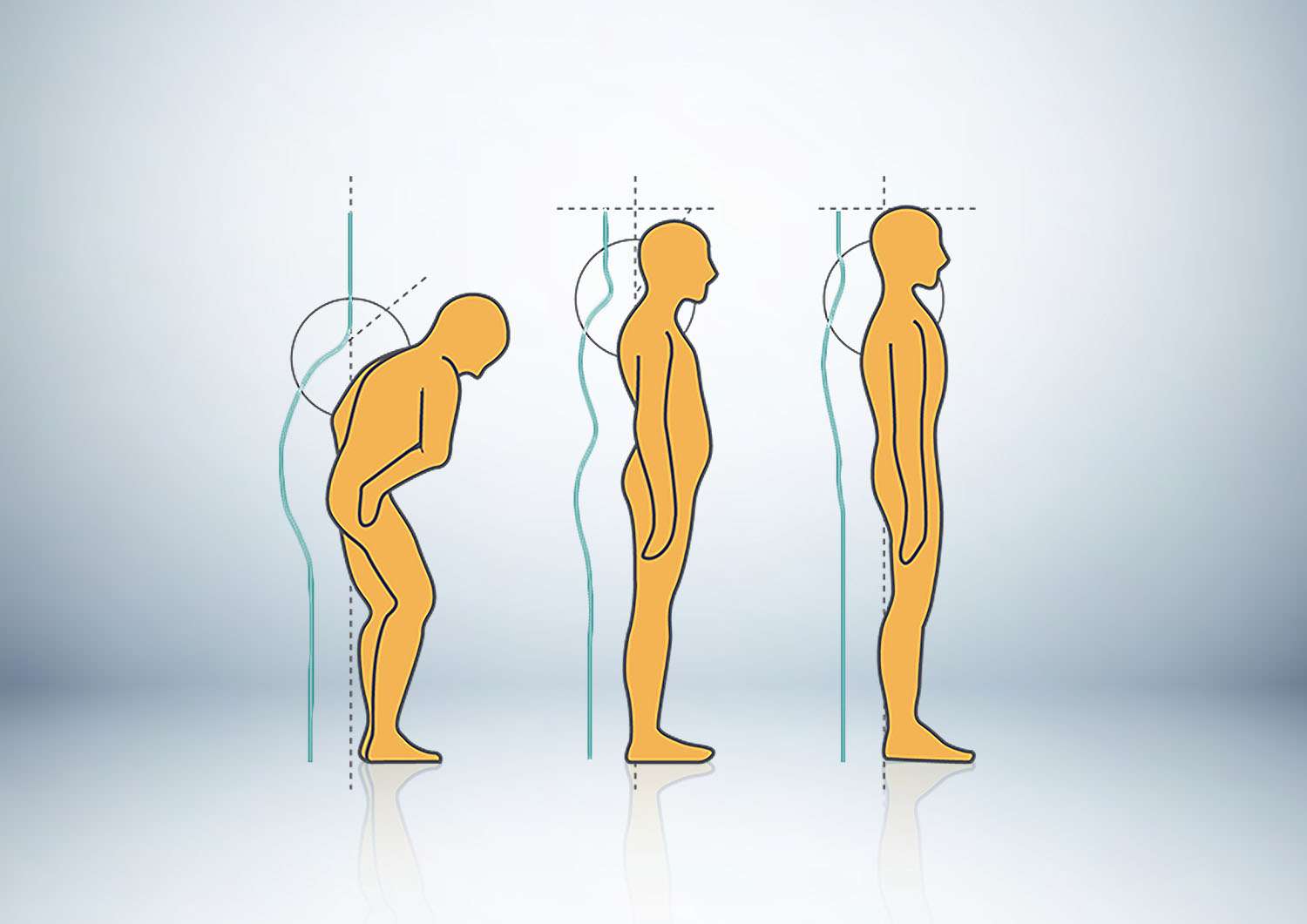 Advanced Bio Structural Correction – ABC™