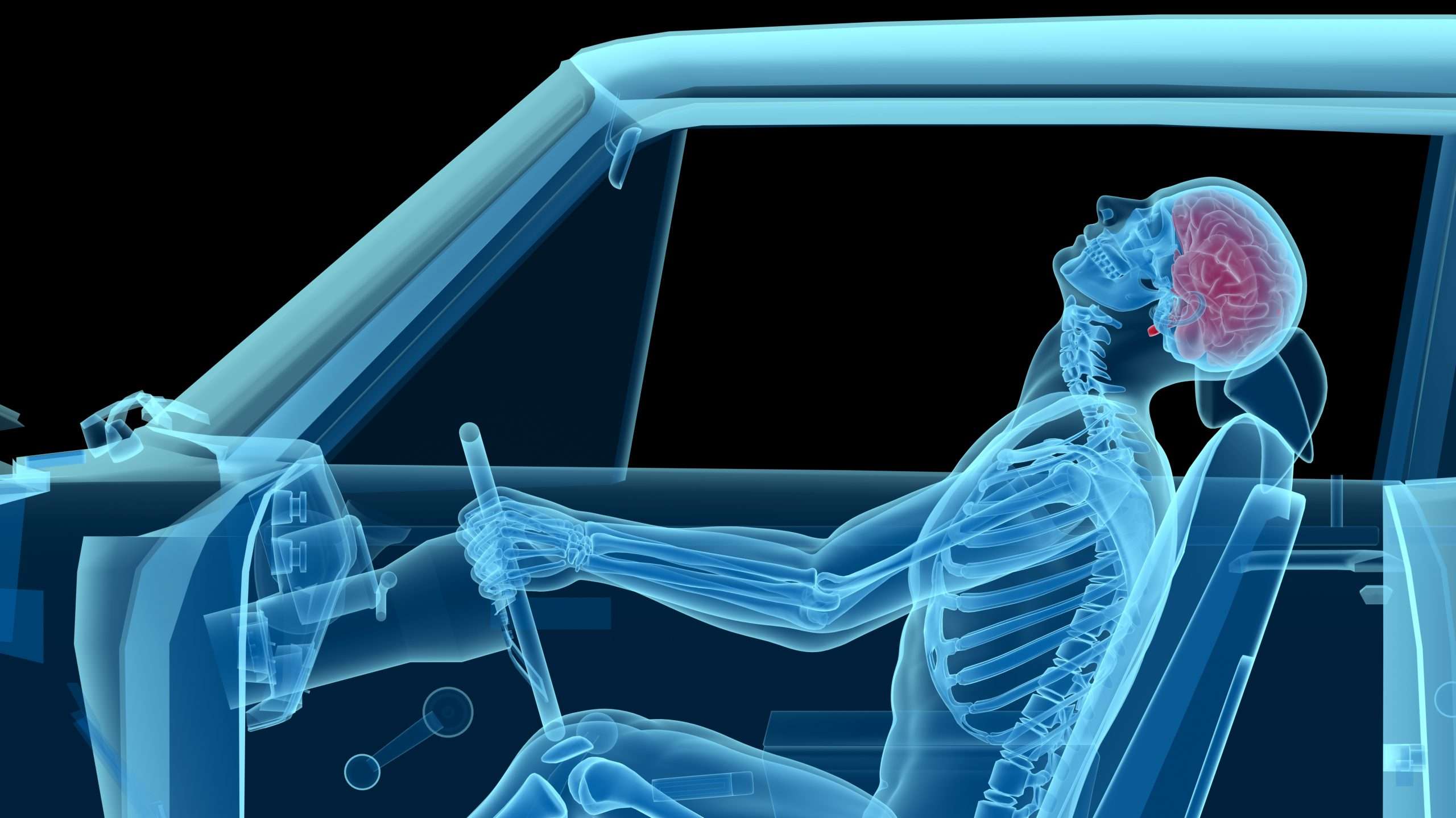 Chiropractic Care for Auto Accident Injuries