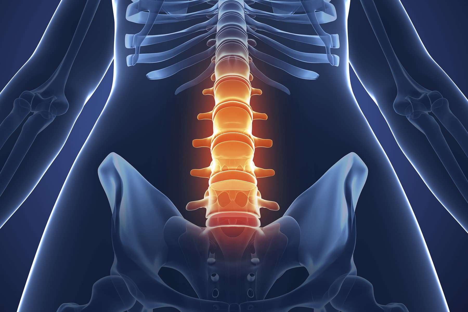 Chiropractic for Scoliosis