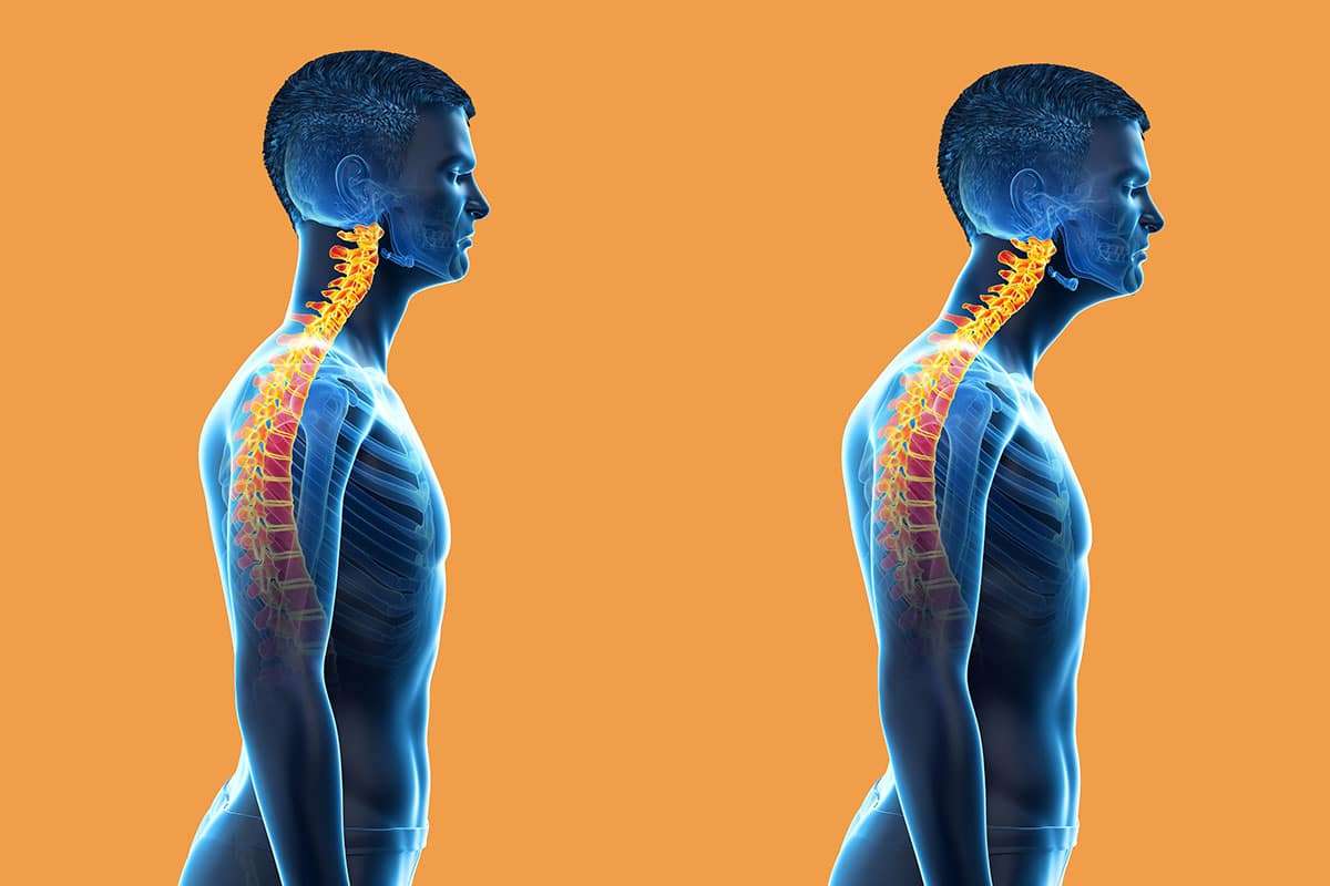 Chiropractic Care for Posture | All You Should Know