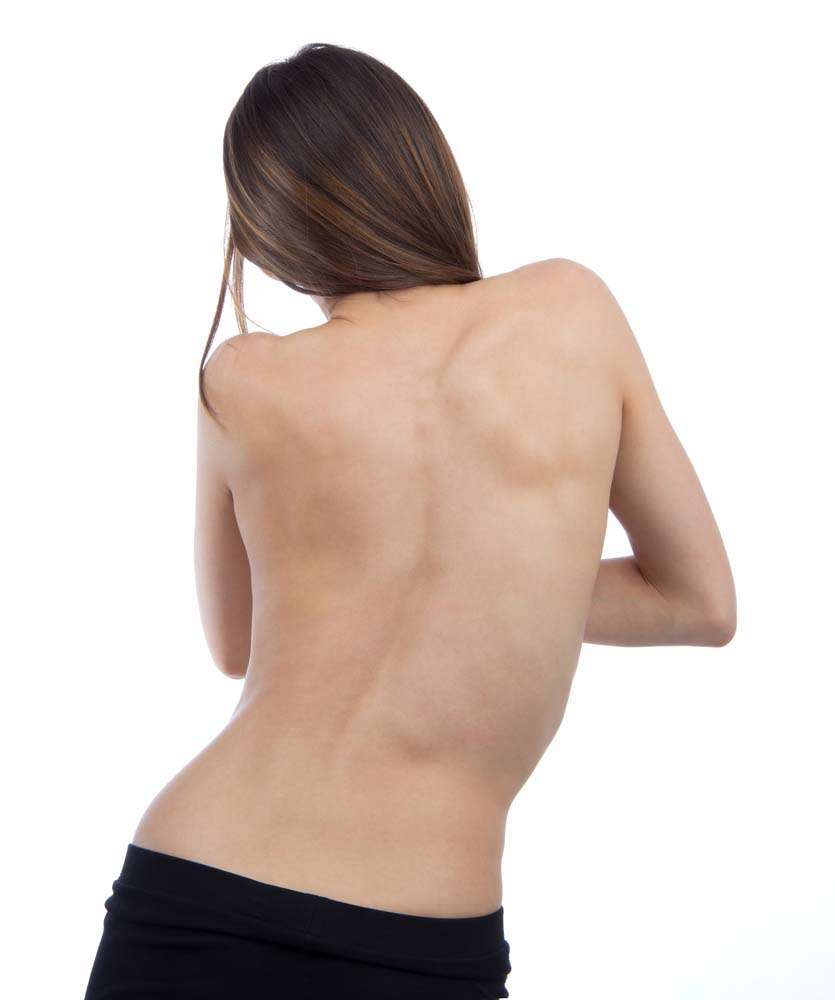 Chiropractic Treatment for Scoliosis